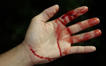 How To Get Fresh Or Dried Blood Out Of Carpet (6 Ways To Do It!)