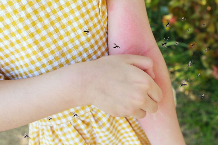 natural ways to keep mosquitoes from biting