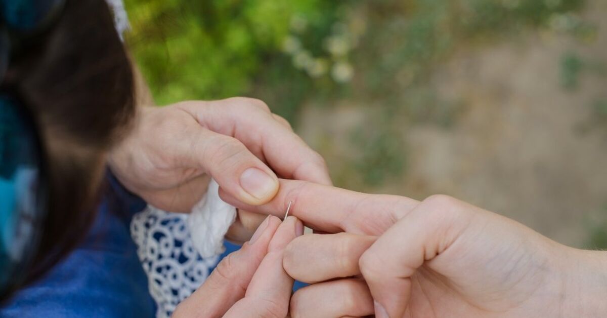 Best Ways To Remove A Splinter That's Deep In Your Skin | Upgradedhome.com