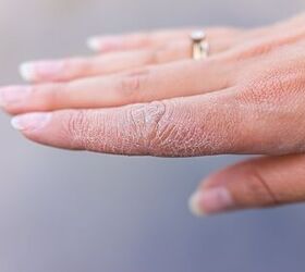 11 Reasons Your Home Is Causing Your Dry, Itchy Skin